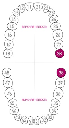 Кламп для коффердама Dentech (Япония) 138